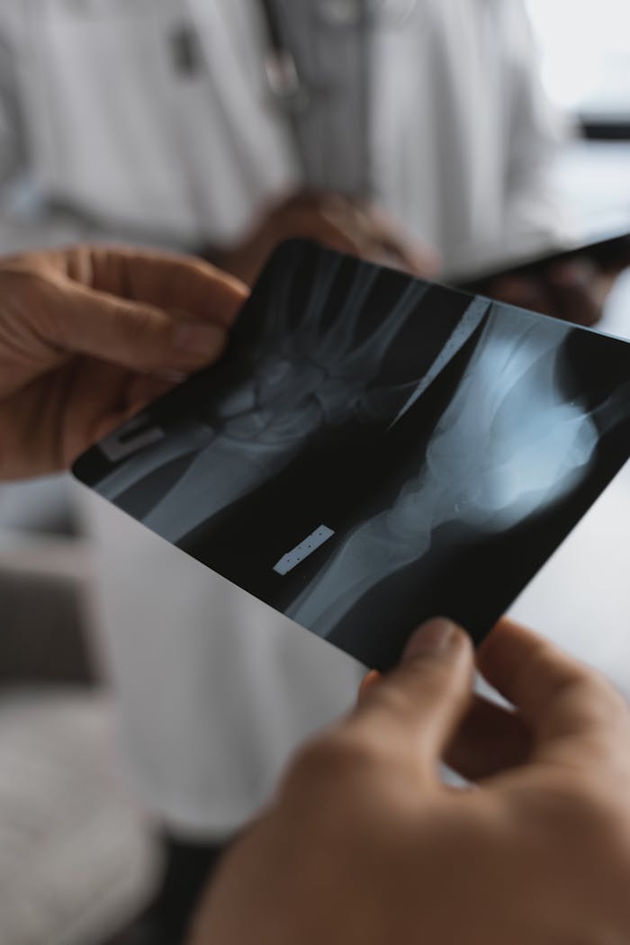 Close-up of hands holding an X-ray image in a medical environment with healthcare professionals.