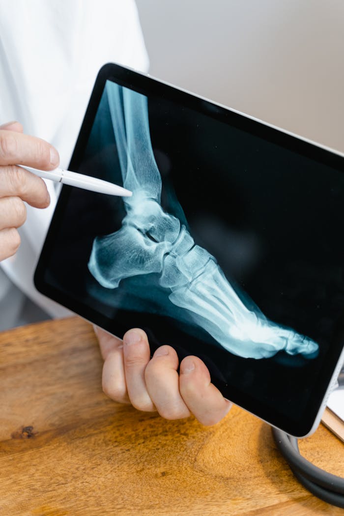 Close-up of a doctor examining a foot x-ray on a tablet, using a stylus for demonstration.